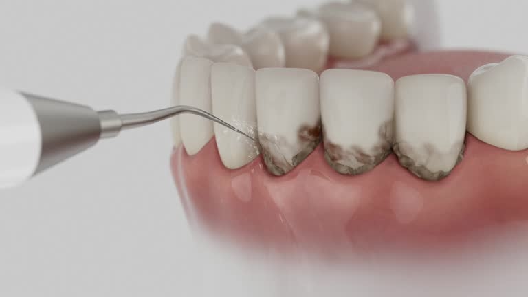 Trusted Emergency Dentist service in Exton, PA - Dentist Open Now